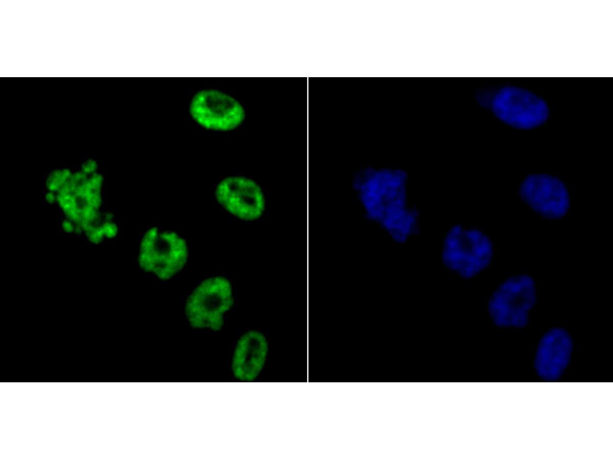 ICC staining of HDAC9 in PC-3M cells (green). Formalin fixed cells were permeabilized with 0.1% Triton X-100 in TBS for 10 minutes at room temperature and blocked with 1% Blocker BSA for 15 minutes at room temperature. Cells were probed with the primary antibody (ET1706-36, 1/50) for 1 hour at room temperature, washed with PBS. Alexa Fluor®488 Goat anti-Rabbit IgG was used as the secondary antibody at 1/1,000 dilution. The nuclear counter stain is DAPI (blue).