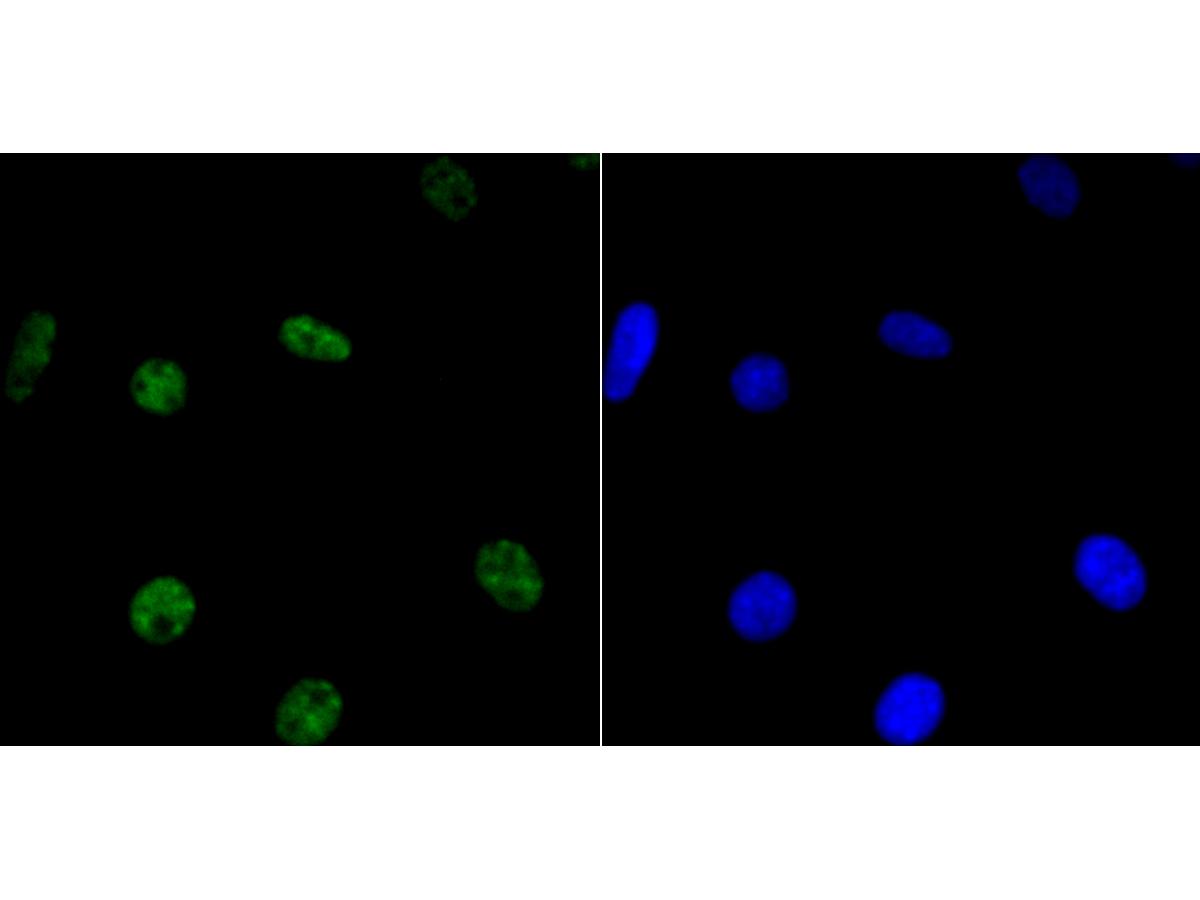 ICC staining of HDAC9 in SH-SY5Y cells (green). Formalin fixed cells were permeabilized with 0.1% Triton X-100 in TBS for 10 minutes at room temperature and blocked with 1% Blocker BSA for 15 minutes at room temperature. Cells were probed with the primary antibody (ET1706-36, 1/50) for 1 hour at room temperature, washed with PBS. Alexa Fluor®488 Goat anti-Rabbit IgG was used as the secondary antibody at 1/1,000 dilution. The nuclear counter stain is DAPI (blue).