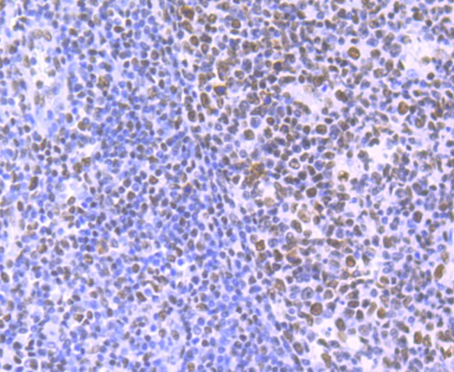 Immunohistochemical analysis of paraffin-embedded human tonsil tissue using anti-HDAC9 antibody. The section was pre-treated using heat mediated antigen retrieval with Tris-EDTA buffer (pH 8.0-8.4) for 20 minutes.The tissues were blocked in 5% BSA for 30 minutes at room temperature, washed with ddH2O and PBS, and then probed with the primary antibody (ET1706-36, 1/50) for 30 minutes at room temperature. The detection was performed using an HRP conjugated compact polymer system. DAB was used as the chromogen. Tissues were counterstained with hematoxylin and mounted with DPX.