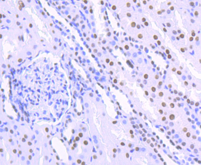 Immunohistochemical analysis of paraffin-embedded human kidney tissue using anti-HDAC9 antibody. The section was pre-treated using heat mediated antigen retrieval with Tris-EDTA buffer (pH 8.0-8.4) for 20 minutes.The tissues were blocked in 5% BSA for 30 minutes at room temperature, washed with ddH2O and PBS, and then probed with the primary antibody (ET1706-36, 1/50) for 30 minutes at room temperature. The detection was performed using an HRP conjugated compact polymer system. DAB was used as the chromogen. Tissues were counterstained with hematoxylin and mounted with DPX.