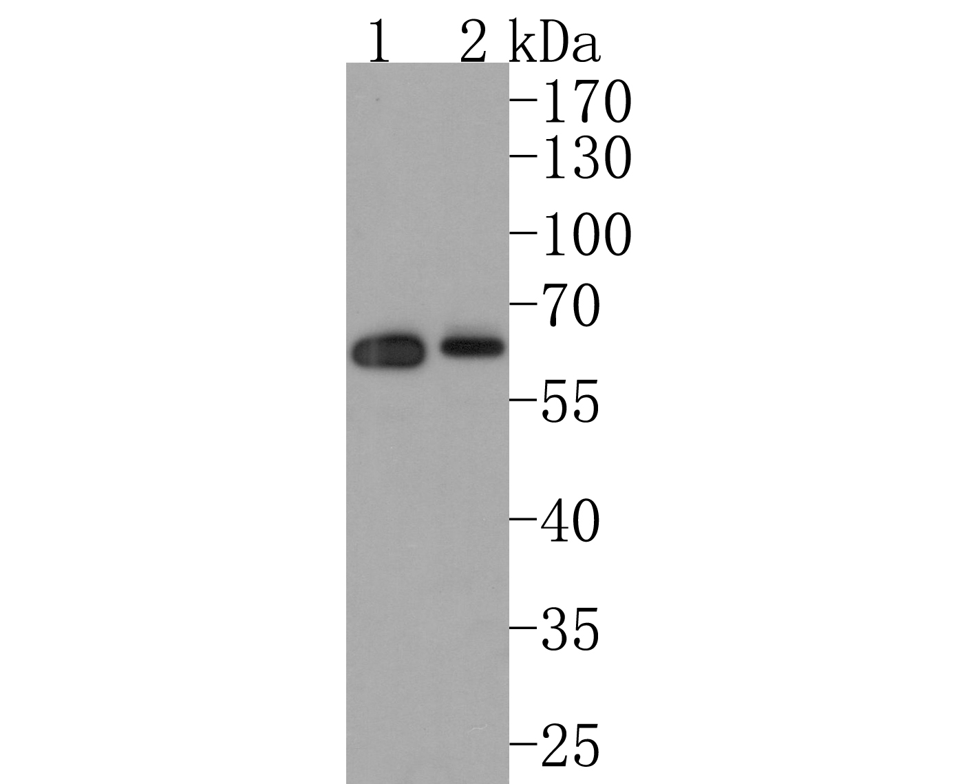 Western blot analysis of Usp14 on different lysates with Rabbit anti-Usp14 antibody (ET1706-37) at 1/500 dilution.<br />
  <br />
Lane 1: K562 cell lysate<br />
Lane 2: Hela cell lysate<br />
<br />
Lysates/proteins at 10 µg/Lane.<br />
<br />
Predicted band size: 56 kDa<br />
Observed band size: 60 kDa<br />
<br />
Exposure time: 2 minutes;<br />
<br />
10% SDS-PAGE gel.<br />
<br />
Proteins were transferred to a PVDF membrane and blocked with 5% NFDM/TBST for 1 hour at room temperature. The primary antibody (ET1706-37) at 1/500 dilution was used in 5% NFDM/TBST at room temperature for 2 hours. Goat Anti-Rabbit IgG - HRP Secondary Antibody (HA1001) at 200,000 dilution was used for 1 hour at room temperature.