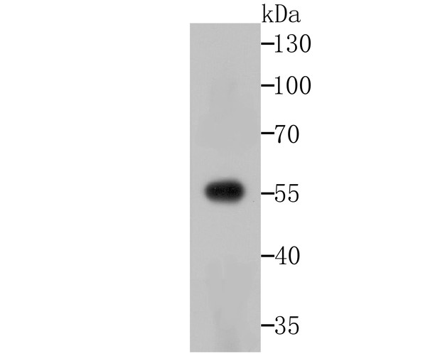 Western blot analysis of Usp14 on zebrafish lysates with Rabbit anti-Usp14 antibody (ET1706-37) at 1/500 dilution.<br />
<br />
Lysates/proteins at 20 µg/Lane.<br />
<br />
Predicted band size: 56 kDa<br />
Observed band size: 60 kDa<br />
<br />
Exposure time: 2 minutes;<br />
<br />
10% SDS-PAGE gel.<br />
<br />
Proteins were transferred to a PVDF membrane and blocked with 5% NFDM/TBST for 1 hour at room temperature. The primary antibody (ET1706-37) at 1/500 dilution was used in 5% NFDM/TBST at room temperature for 2 hours. Goat Anti-Rabbit IgG - HRP Secondary Antibody (HA1001) at 1:200,000 dilution was used for 1 hour at room temperature.
