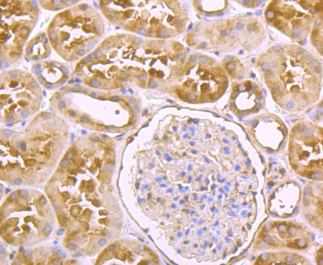 Immunohistochemical analysis of paraffin-embedded human kidney tissue with Rabbit anti-Usp14 antibody (ET1706-37) at 1/50 dilution.<br />
<br />
The section was pre-treated using heat mediated antigen retrieval with Tris-EDTA buffer (pH 9.0) for 20 minutes. The tissues were blocked in 1% BSA for 20 minutes at room temperature, washed with ddH2O and PBS, and then probed with the primary antibody (ET1706-37) at 1/50 dilution for 0.5 hour at room temperature. The detection was performed using an HRP conjugated compact polymer system. DAB was used as the chromogen. Tissues were counterstained with hematoxylin and mounted with DPX.