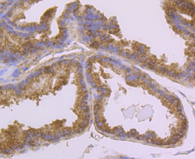 Immunohistochemical analysis of paraffin-embedded mouse prostate tissue with Rabbit anti-Usp14 antibody (ET1706-37) at 1/50 dilution.<br />
<br />
The section was pre-treated using heat mediated antigen retrieval with Tris-EDTA buffer (pH 9.0) for 20 minutes. The tissues were blocked in 1% BSA for 20 minutes at room temperature, washed with ddH2O and PBS, and then probed with the primary antibody (ET1706-37) at 1/50 dilution for 0.5 hour at room temperature. The detection was performed using an HRP conjugated compact polymer system. DAB was used as the chromogen. Tissues were counterstained with hematoxylin and mounted with DPX.