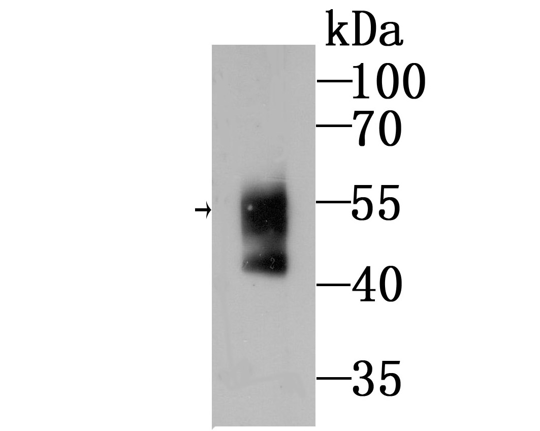 Western blot analysis of WASL on mouse Human serum lysates using anti-Ubiquitin antibody at 1/500 dilution.