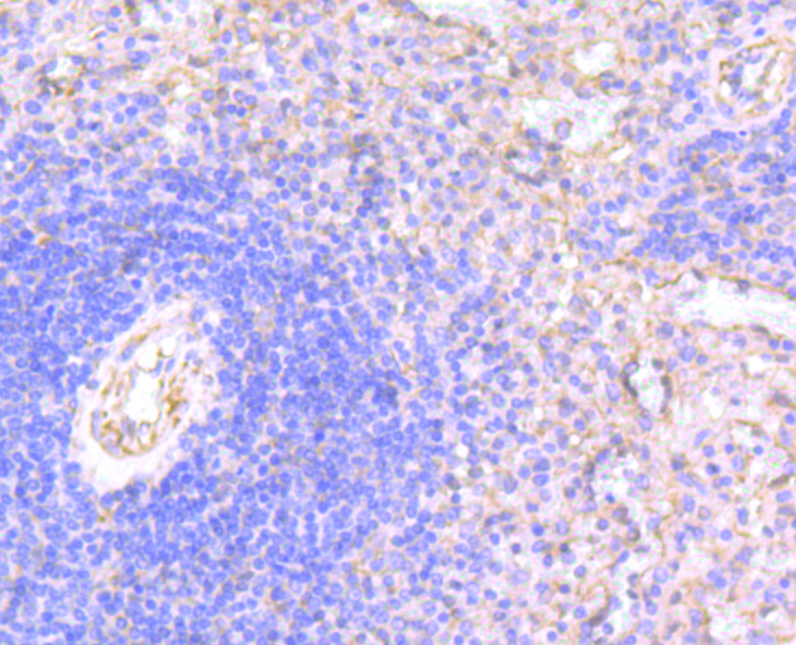 Immunohistochemical analysis of paraffin-embedded human spleen tissue using anti-WASL antibody. Counter stained with hematoxylin.