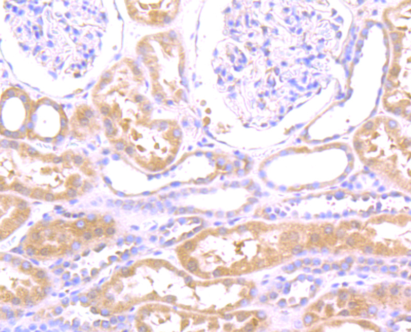 Immunohistochemical analysis of paraffin-embedded human kidney tissue using anti-WASL antibody. Counter stained with hematoxylin.
