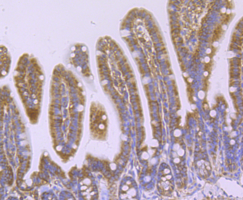 Immunohistochemical analysis of paraffin-embedded mouse colon tissue using anti-WASL antibody. Counter stained with hematoxylin.