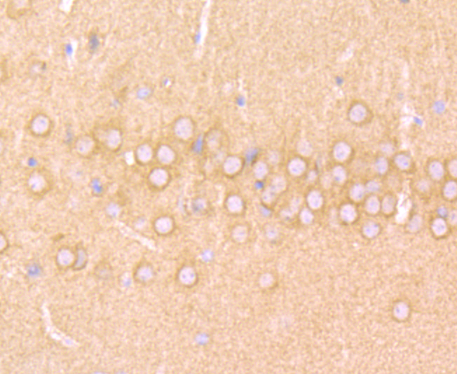 Immunohistochemical analysis of paraffin-embedded mouse brain tissue using anti-WASL antibody. Counter stained with hematoxylin.