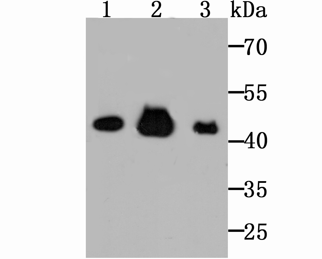 Western blot analysis of Citrate synthetase on different lysates with Rabbit anti-Citrate synthetase antibody (ET1706-40) at 1/1,000 dilution.<br />
  <br />
Lane 1: Rat kidney tissue lysates (20 µg/Lane)<br />
Lane 2: Hela cell lysates<br />
Lane 3: Mouse brain tissue lysates (20 µg/Lane)<br />
<br />
Lysates/proteins at 10 µg/Lane.<br />
<br />
Predicted band size: 52 kDa<br />
Observed band size: 50 kDa<br />
<br />
Exposure time: 2 minutes;<br />
<br />
10% SDS-PAGE gel.<br />
<br />
Proteins were transferred to a PVDF membrane and blocked with 5% NFDM/TBST for 1 hour at room temperature. The primary antibody (ET1706-40) at 1/1,000 dilution was used in 5% NFDM/TBST at room temperature for 2 hours. Goat Anti-Rabbit IgG - HRP Secondary Antibody (HA1001) at 200,000 dilution was used for 1 hour at room temperature.