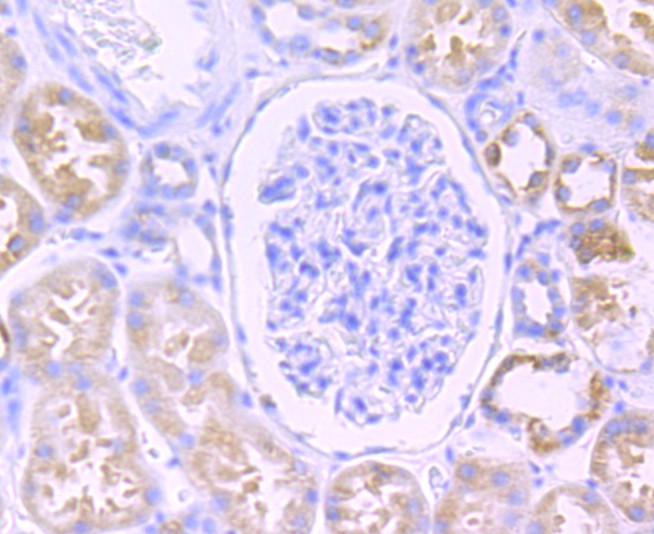 Immunohistochemical analysis of paraffin-embedded human kidney tissue with Rabbit anti-Citrate synthetase antibody (ET1706-40) at 1/50 dilution.<br />
<br />
The section was pre-treated using heat mediated antigen retrieval with Tris-EDTA buffer (pH 8.0-8.4) for 20 minutes. The tissues were blocked in 1% BSA for 20 minutes at room temperature, washed with ddH2O and PBS, and then probed with the primary antibody (ET1706-40) at 1/50 dilution for 0.5 hour at room temperature. The detection was performed using an HRP conjugated compact polymer system. DAB was used as the chromogen. Tissues were counterstained with hematoxylin and mounted with DPX.