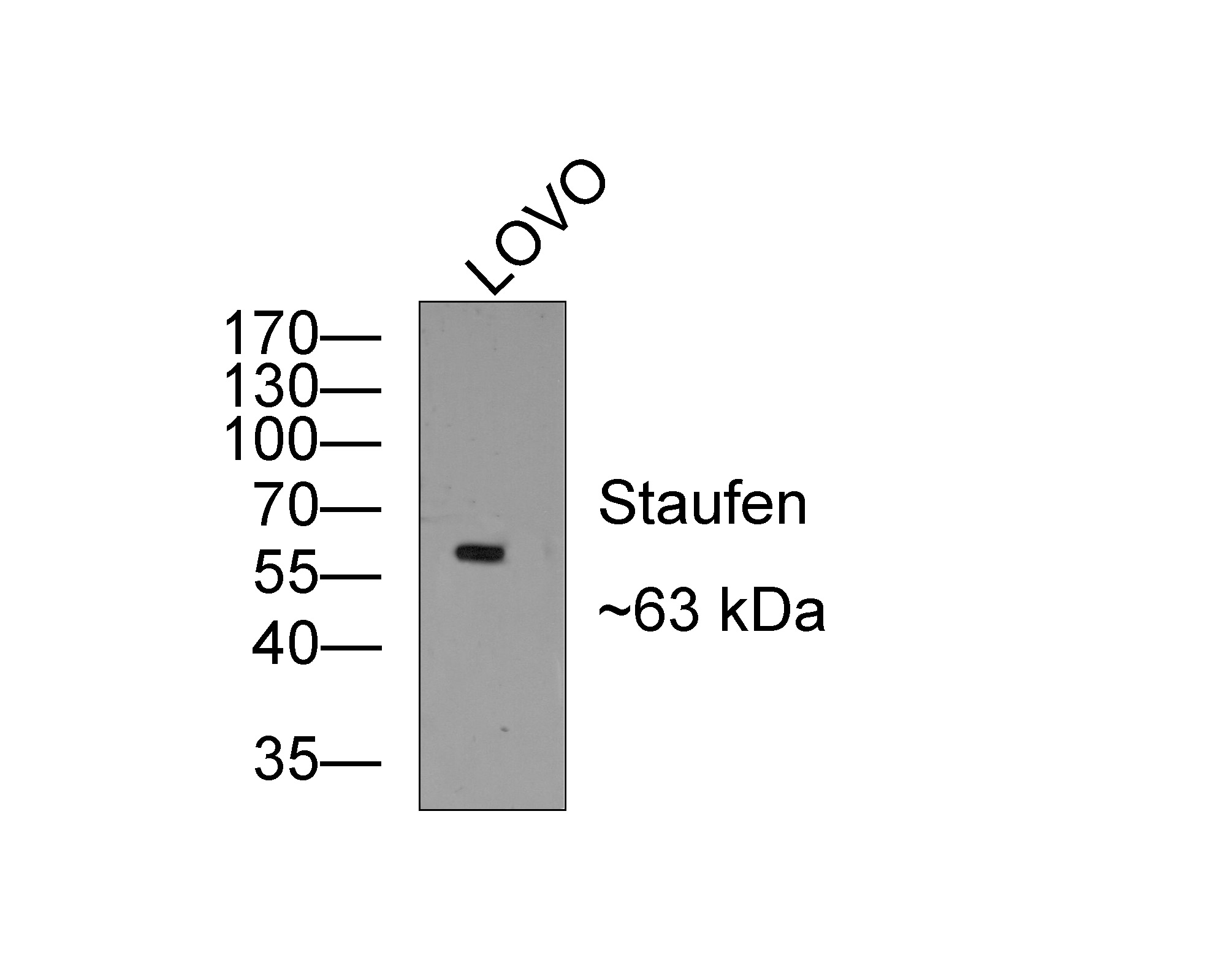 Western blot analysis of Staufen on LOVO cell lysates with Rabbit anti-Staufen antibody (ET1706-41) at 1/500 dilution.<br />
<br />
Lysates/proteins at 10 µg/Lane.<br />
<br />
Predicted band size: 63 kDa<br />
Observed band size: 53 kDa<br />
<br />
Exposure time: 2 minutes;<br />
<br />
10% SDS-PAGE gel.<br />
<br />
Proteins were transferred to a PVDF membrane and blocked with 5% NFDM/TBST for 1 hour at room temperature. The primary antibody (ET1706-41) at 1/500 dilution was used in 5% NFDM/TBST at room temperature for 2 hours. Goat Anti-Rabbit IgG - HRP Secondary Antibody (HA1001) at 1:200,000 dilution was used for 1 hour at room temperature.