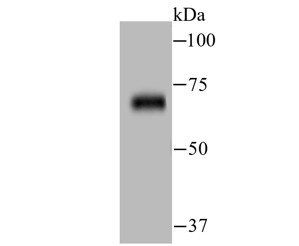 Western blot analysis of ZAP70 on human thymus tissue lysates. Proteins were transferred to a PVDF membrane and blocked with 5% BSA in PBS for 1 hour at room temperature. The primary antibody (ET1706-42, 1/500) was used in 5% BSA at room temperature for 2 hours. Goat Anti-Rabbit IgG - HRP Secondary Antibody (HA1001) at 1:200,000 dilution was used for 1 hour at room temperature.<br />
<br />
Predicted band size: 70 kDa<br />
Observed band size: 70 kDa