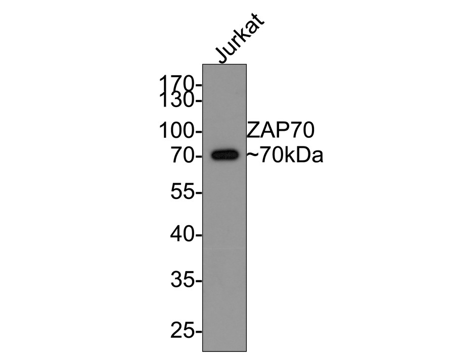 Western blot analysis of ZAP70 on Jurkat cell lysates with Rabbit anti-ZAP70 antibody (ET1706-42) at 1/500 dilution.<br />
<br />
Lysates/proteins at 10 µg/Lane.<br />
<br />
Predicted band size: 70 kDa<br />
Observed band size: 70 kDa<br />
<br />
Exposure time: 30 seconds;<br />
<br />
10% SDS-PAGE gel.<br />
<br />
Proteins were transferred to a PVDF membrane and blocked with 5% NFDM/TBST for 1 hour at room temperature. The primary antibody (ET1706-42) at 1/500 dilution was used in 5% NFDM/TBST at room temperature for 2 hours. Goat Anti-Rabbit IgG - HRP Secondary Antibody (HA1001) at 1:200,000 dilution was used for 1 hour at room temperature.