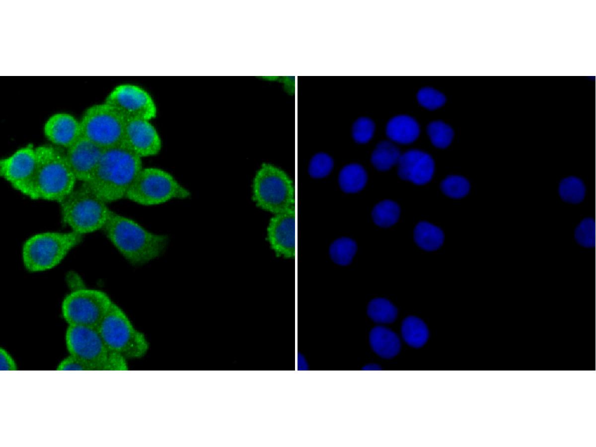 ICC staining of ZAP70 in SH-SY5Y cells (green). Formalin fixed cells were permeabilized with 0.1% Triton X-100 in TBS for 10 minutes at room temperature and blocked with 10% negative goat serum for 15 minutes at room temperature. Cells were probed with the primary antibody (ET1706-42, 1/50) for 1 hour at room temperature, washed with PBS. Alexa Fluor®488 conjugate-Goat anti-Rabbit IgG was used as the secondary antibody at 1/1,000 dilution. The nuclear counter stain is DAPI (blue).