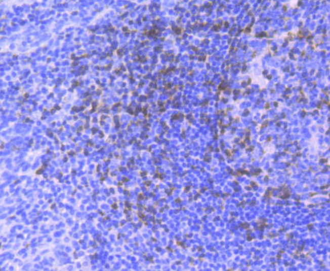 Immunohistochemical analysis of paraffin-embedded human tonsil tissue with Rabbit anti-ZAP70 antibody (ET1706-42) at 1/50 dilution.<br />
<br />
The section was pre-treated using heat mediated antigen retrieval with Tris-EDTA buffer (pH 9.0) for 20 minutes. The tissues were blocked in 1% BSA for 20 minutes at room temperature, washed with ddH2O and PBS, and then probed with the primary antibody (ET1706-42) at 1/50 dilution for 0.5 hour at room temperature. The detection was performed using an HRP conjugated compact polymer system. DAB was used as the chromogen. Tissues were counterstained with hematoxylin and mounted with DPX.
