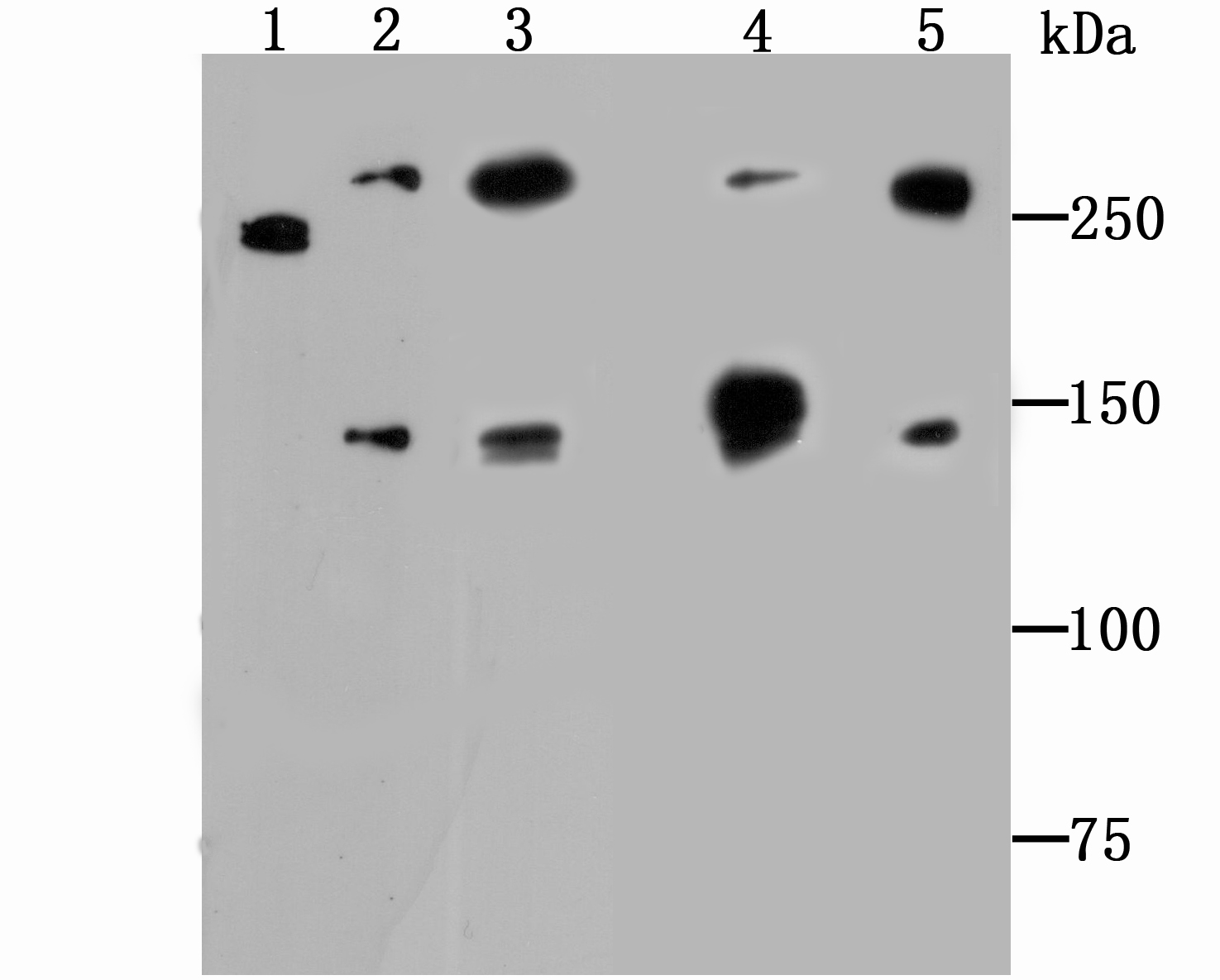 Western blot analysis of Alpha Fodrin on different lysates. Proteins were transferred to a PVDF membrane and blocked with 5% BSA in PBS for 1 hour at room temperature. The primary antibody (ET1706-44, 1/500) was used in 5% BSA at room temperature for 2 hours. Goat Anti-Rabbit IgG - HRP Secondary Antibody (HA1001) at 1:200,000 dilution was used for 1 hour at room temperature.<br />
Positive control: <br />
Lane 1: Hela cell lysate<br />
Lane 2: Jurkat cell lysate<br />
Lane 3: NIH/3T3 cell lysate<br />
Lane 4:Rat brain tissue lysate<br />
Lane 5:Mouse brain tissue lysate