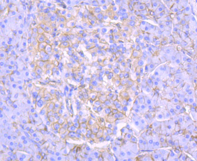 Immunohistochemical analysis of paraffin-embedded human pancreas tissue using anti-Alpha Fodrin antibody. The section was pre-treated using heat mediated antigen retrieval with Tris-EDTA buffer (pH 9.0) for 20 minutes.The tissues were blocked in 1% BSA for 30 minutes at room temperature, washed with ddH2O and PBS, and then probed with the primary antibody (ET1706-44, 1/50) for 30 minutes at room temperature. The detection was performed using an HRP conjugated compact polymer system. DAB was used as the chromogen. Tissues were counterstained with hematoxylin and mounted with DPX.