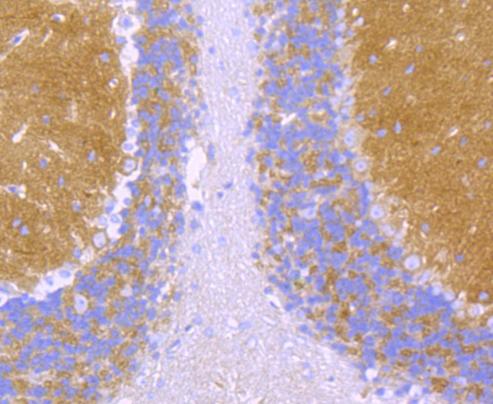 Immunohistochemical analysis of paraffin-embedded mouse cerebellum tissue using anti-Alpha Fodrin antibody. The section was pre-treated using heat mediated antigen retrieval with Tris-EDTA buffer (pH 9.0) for 20 minutes.The tissues were blocked in 1% BSA for 30 minutes at room temperature, washed with ddH2O and PBS, and then probed with the primary antibody (ET1706-44, 1/50) for 30 minutes at room temperature. The detection was performed using an HRP conjugated compact polymer system. DAB was used as the chromogen. Tissues were counterstained with hematoxylin and mounted with DPX.