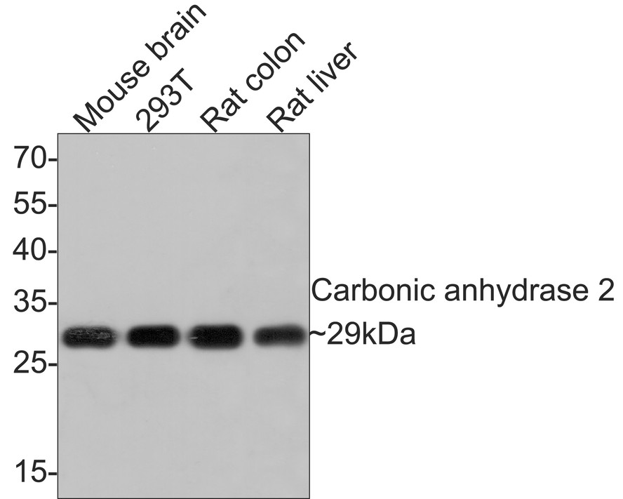 Western blot analysis of Carbonic anhydrase 2 on different lysates with Rabbit anti-Carbonic anhydrase 2 antibody (ET1706-47) at 1/2,000 dilution.<br />
<br />
Lane 1: Mouse brain tissue lysate (20 µg/Lane)<br />
Lane 2: 293T cell lysate (10 µg/Lane)<br />
Lane 3: Rat colon tissue lysate (20 µg/Lane)<br />
Lane 4: Rat liver tissue lysate (20 µg/Lane)<br />
<br />
Predicted band size: 29 kDa<br />
Observed band size: 29 kDa<br />
<br />
Exposure time: 2 minutes;<br />
<br />
12% SDS-PAGE gel.<br />
<br />
Proteins were transferred to a PVDF membrane and blocked with 5% NFDM/TBST for 1 hour at room temperature. The primary antibody (ET1706-47) at 1/2,000 dilution was used in 5% NFDM/TBST at room temperature for 2 hours. Goat Anti-Rabbit IgG - HRP Secondary Antibody (HA1001) at 1:300,000 dilution was used for 1 hour at room temperature.