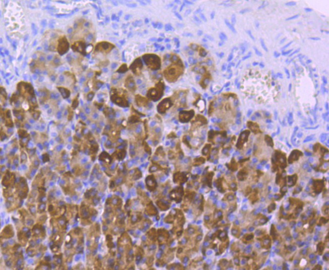 Immunohistochemical analysis of paraffin-embedded rat stomach tissue with Rabbit anti-Carbonic anhydrase 2 antibody (ET1706-47) at 1/50 dilution.<br />
<br />
The section was pre-treated using heat mediated antigen retrieval with Tris-EDTA buffer (pH 8.0-8.4) for 20 minutes. The tissues were blocked in 1% BSA for 20 minutes at room temperature, washed with ddH2O and PBS, and then probed with the primary antibody (ET1706-47) at 1/50 dilution for 0.5 hour at room temperature. The detection was performed using an HRP conjugated compact polymer system. DAB was used as the chromogen. Tissues were counterstained with hematoxylin and mounted with DPX.