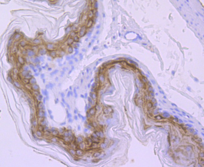 Immunohistochemical analysis of paraffin-embedded mouse stomach tissue with Rabbit anti-Carbonic anhydrase 2 antibody (ET1706-47) at 1/50 dilution.<br />
<br />
The section was pre-treated using heat mediated antigen retrieval with Tris-EDTA buffer (pH 8.0-8.4) for 20 minutes. The tissues were blocked in 1% BSA for 20 minutes at room temperature, washed with ddH2O and PBS, and then probed with the primary antibody (ET1706-47) at 1/50 dilution for 0.5 hour at room temperature. The detection was performed using an HRP conjugated compact polymer system. DAB was used as the chromogen. Tissues were counterstained with hematoxylin and mounted with DPX.