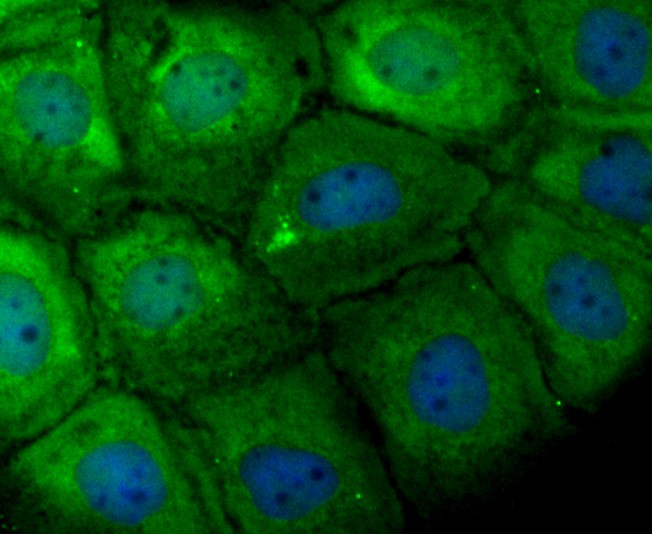 ICC staining of TCTP in A431 cells (green). Formalin fixed cells were permeabilized with 0.1% Triton X-100 in TBS for 10 minutes at room temperature and blocked with 1% Blocker BSA for 15 minutes at room temperature. Cells were probed with the primary antibody (ET1706-48, 1/50) for 1 hour at room temperature, washed with PBS. Alexa Fluor®488 Goat anti-Rabbit IgG was used as the secondary antibody at 1/1,000 dilution. The nuclear counter stain is DAPI (blue).