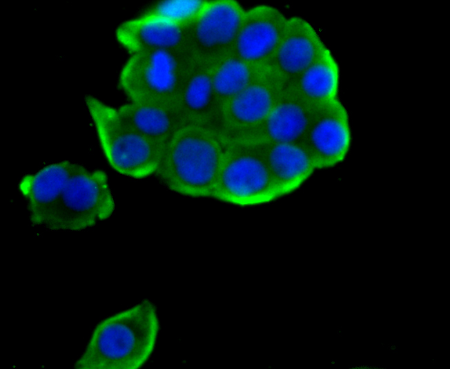 ICC staining of TCTP in LOVO cells (green). Formalin fixed cells were permeabilized with 0.1% Triton X-100 in TBS for 10 minutes at room temperature and blocked with 1% Blocker BSA for 15 minutes at room temperature. Cells were probed with the primary antibody (ET1706-48, 1/50) for 1 hour at room temperature, washed with PBS. Alexa Fluor®488 Goat anti-Rabbit IgG was used as the secondary antibody at 1/1,000 dilution. The nuclear counter stain is DAPI (blue).