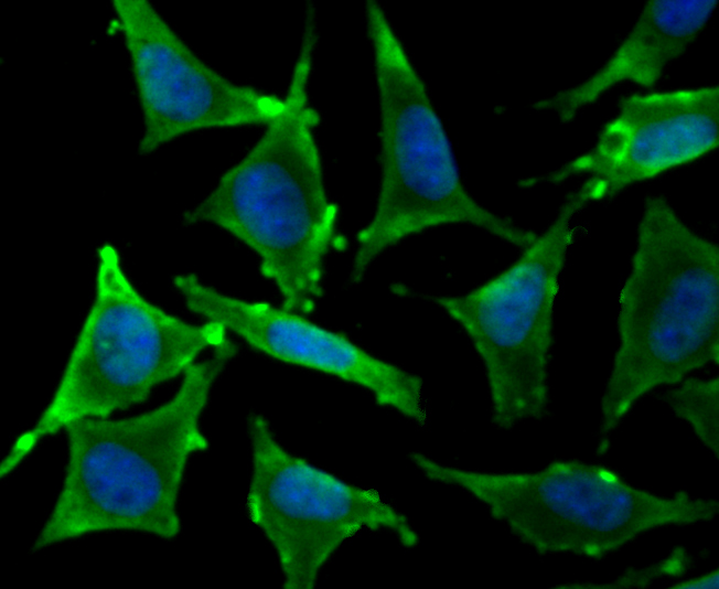 ICC staining of TCTP in SH-SY5Y cells (green). Formalin fixed cells were permeabilized with 0.1% Triton X-100 in TBS for 10 minutes at room temperature and blocked with 1% Blocker BSA for 15 minutes at room temperature. Cells were probed with the primary antibody (ET1706-48, 1/50) for 1 hour at room temperature, washed with PBS. Alexa Fluor®488 Goat anti-Rabbit IgG was used as the secondary antibody at 1/1,000 dilution. The nuclear counter stain is DAPI (blue).