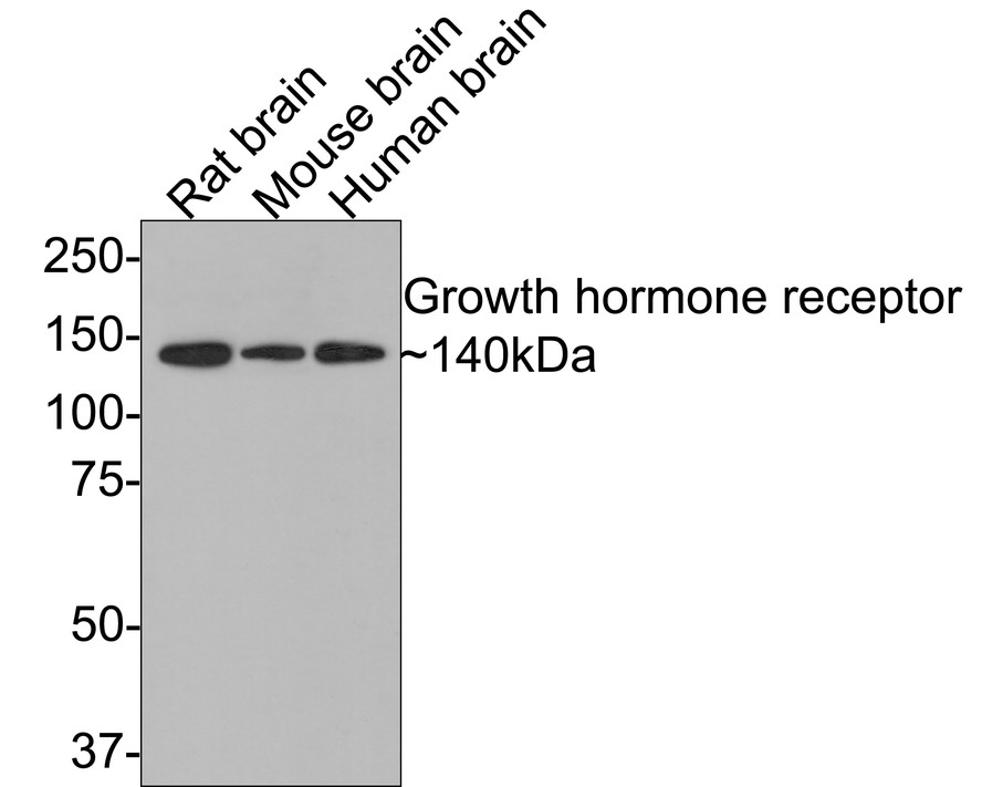 Western blot analysis of Growth hormone receptor on different lysates with Rabbit anti-Growth hormone receptor antibody (ET1706-49) at 1/500 dilution.<br />
<br />
Lane 1: Rat brain tissue lysate<br />
Lane 2: Mouse brain tissue lysate<br />
Lane 3: Human brain tissue lysate<br />
<br />
Lysates/proteins at 20 µg/Lane.<br />
<br />
Predicted band size: 71 kDa<br />
Observed band size: 140 kDa<br />
<br />
Exposure time: 2 minutes;<br />
<br />
8% SDS-PAGE gel.<br />
<br />
Proteins were transferred to a PVDF membrane and blocked with 5% NFDM/TBST for 1 hour at room temperature. The primary antibody (ET1706-49) at 1/500 dilution was used in 5% NFDM/TBST at room temperature for 2 hours. Goat Anti-Rabbit IgG - HRP Secondary Antibody (HA1001) at 1:300,000 dilution was used for 1 hour at room temperature.
