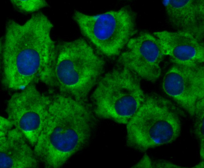 ICC staining of Growth hormone receptor in HepG2 cells (green). Formalin fixed cells were permeabilized with 0.1% Triton X-100 in TBS for 10 minutes at room temperature and blocked with 10% negative goat serum for 15 minutes at room temperature. Cells were probed with the primary antibody (ET1706-49, 1/200) for 1 hour at room temperature, washed with PBS. Alexa Fluor®488 conjugate-Goat anti-Rabbit IgG was used as the secondary antibody at 1/1,000 dilution. The nuclear counter stain is DAPI (blue).
