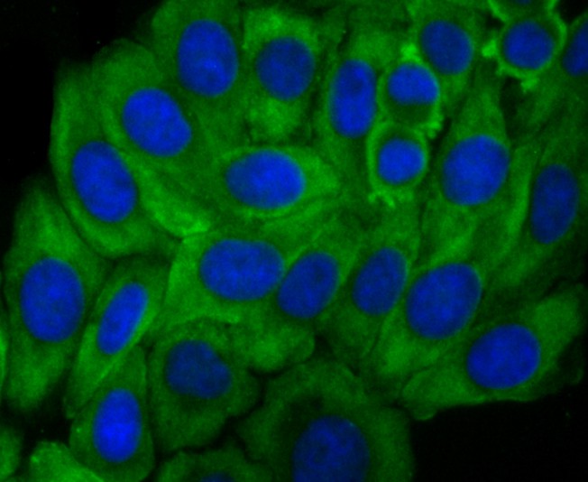 ICC staining of Growth hormone receptor in JAR cells (green). Formalin fixed cells were permeabilized with 0.1% Triton X-100 in TBS for 10 minutes at room temperature and blocked with 10% negative goat serum for 15 minutes at room temperature. Cells were probed with the primary antibody (ET1706-49, 1/200) for 1 hour at room temperature, washed with PBS. Alexa Fluor®488 conjugate-Goat anti-Rabbit IgG was used as the secondary antibody at 1/1,000 dilution. The nuclear counter stain is DAPI (blue).