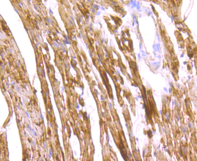 Immunohistochemical analysis of paraffin-embedded mouse heart tissue with Rabbit anti-FABP3 antibody (ET1706-50) at 1/50 dilution.<br />
<br />
The section was pre-treated using heat mediated antigen retrieval with Tris-EDTA buffer (pH 9.0) for 20 minutes. The tissues were blocked in 1% BSA for 20 minutes at room temperature, washed with ddH2O and PBS, and then probed with the primary antibody (ET1706-50) at 1/50 dilution for 0.5 hour at room temperature. The detection was performed using an HRP conjugated compact polymer system. DAB was used as the chromogen. Tissues were counterstained with hematoxylin and mounted with DPX.