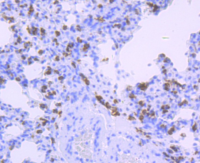 Immunohistochemical analysis of paraffin-embedded rat lung tissue with Rabbit anti-HLA-DQA1 antibody (ET1706-51) at 1/50 dilution.<br />
<br />
The section was pre-treated using heat mediated antigen retrieval with Tris-EDTA buffer (pH 9.0) for 20 minutes. The tissues were blocked in 1% BSA for 20 minutes at room temperature, washed with ddH2O and PBS, and then probed with the primary antibody (ET1706-51) at 1/50 dilution for 0.5 hour at room temperature. The detection was performed using an HRP conjugated compact polymer system. DAB was used as the chromogen. Tissues were counterstained with hematoxylin and mounted with DPX.