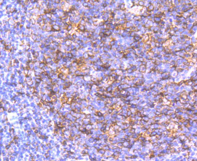 Immunohistochemical analysis of paraffin-embedded human tonsil tissue with Rabbit anti-HLA-DQA1 antibody (ET1706-51) at 1/50 dilution.<br />
<br />
The section was pre-treated using heat mediated antigen retrieval with Tris-EDTA buffer (pH 9.0) for 20 minutes. The tissues were blocked in 1% BSA for 20 minutes at room temperature, washed with ddH2O and PBS, and then probed with the primary antibody (ET1706-51) at 1/50 dilution for 0.5 hour at room temperature. The detection was performed using an HRP conjugated compact polymer system. DAB was used as the chromogen. Tissues were counterstained with hematoxylin and mounted with DPX.