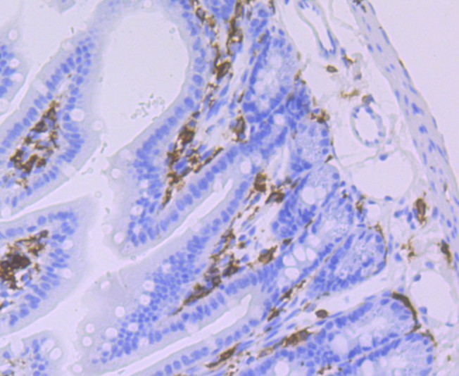 Immunohistochemical analysis of paraffin-embedded mouse colon tissue with Rabbit anti-HLA-DQA1 antibody (ET1706-51) at 1/50 dilution.<br />
<br />
The section was pre-treated using heat mediated antigen retrieval with Tris-EDTA buffer (pH 9.0) for 20 minutes. The tissues were blocked in 1% BSA for 20 minutes at room temperature, washed with ddH2O and PBS, and then probed with the primary antibody (ET1706-51) at 1/50 dilution for 0.5 hour at room temperature. The detection was performed using an HRP conjugated compact polymer system. DAB was used as the chromogen. Tissues were counterstained with hematoxylin and mounted with DPX.
