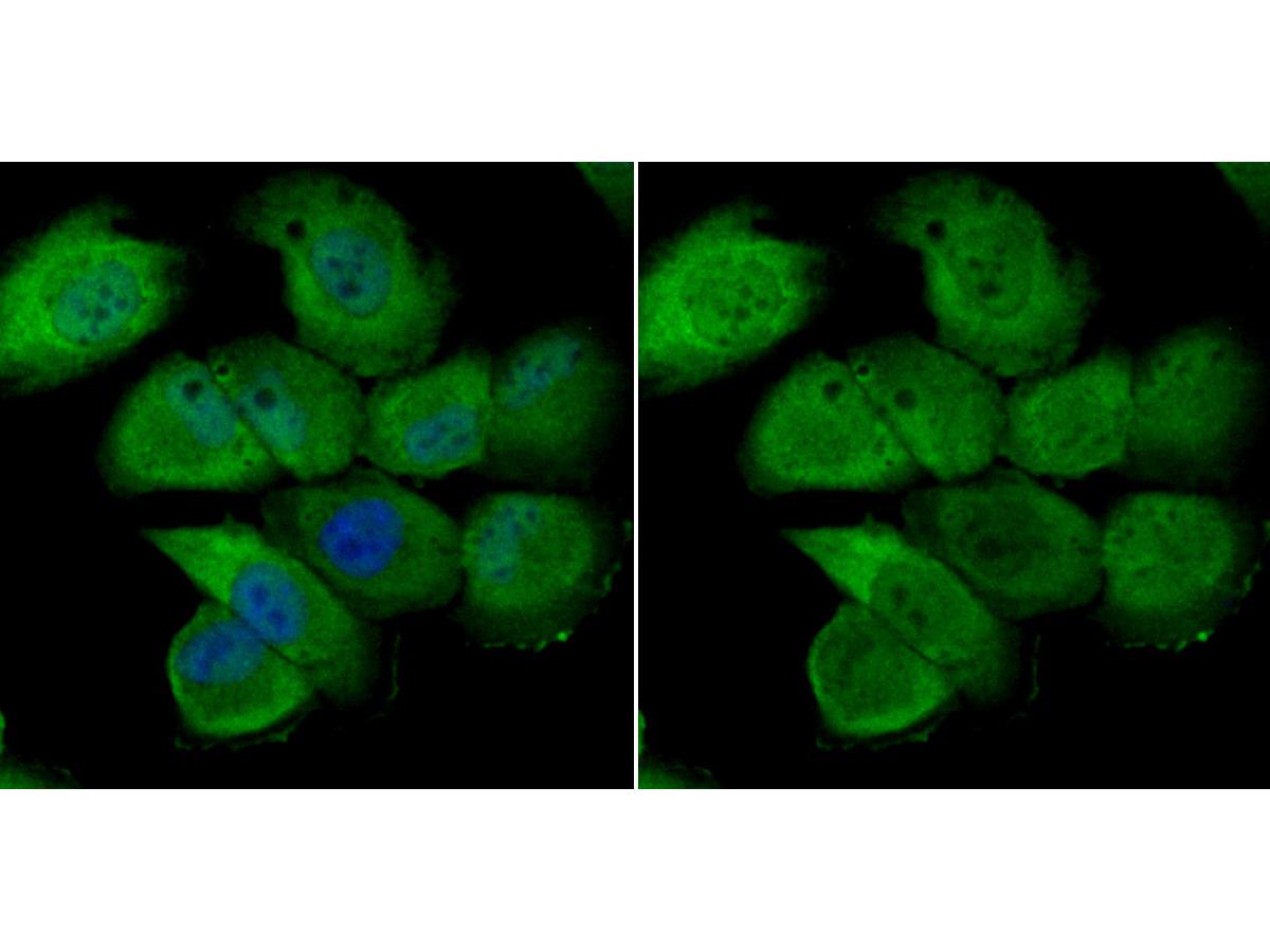 ICC staining Nuclear Matrix Protein p84 in HUVEC cells (green). The nuclear counter stain is DAPI (blue). Cells were fixed in paraformaldehyde, permeabilised with 0.25% Triton X100/PBS.