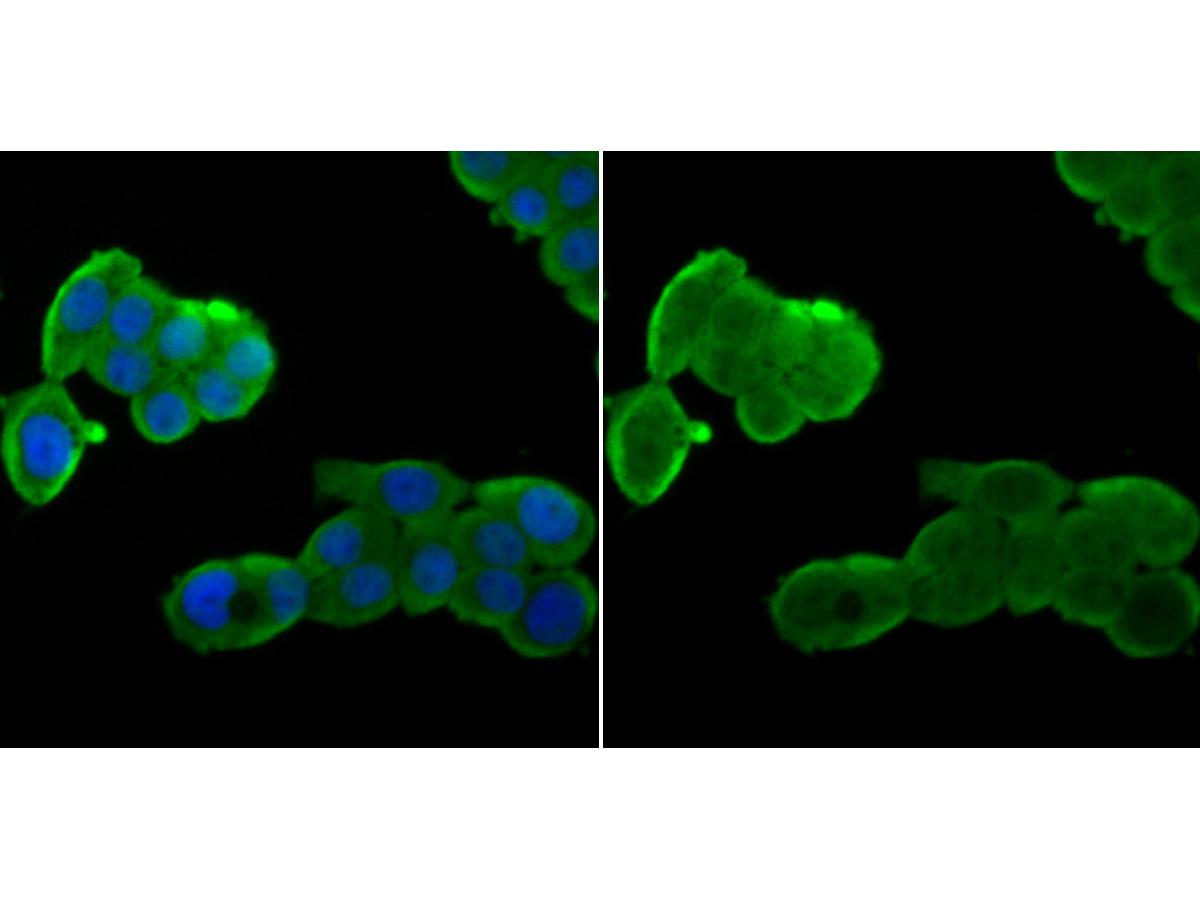 ICC staining Nuclear Matrix Protein p84 in LOVO cells (green). The nuclear counter stain is DAPI (blue). Cells were fixed in paraformaldehyde, permeabilised with 0.25% Triton X100/PBS.
