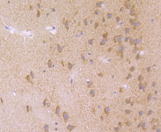 Immunohistochemical analysis of paraffin-embedded rat brain tissue using anti-Nuclear Matrix Protein p84 antibody. Counter stained with hematoxylin.