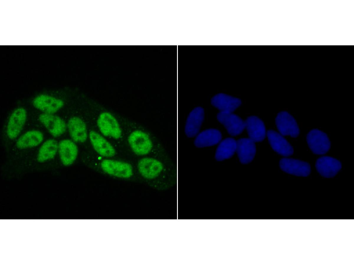 Immunocytochemistry analysis of Hela cells labeling RbAP48 with Rabbit anti-RbAP48 antibody (ET1706-54) at 1/50 dilution.<br />
<br />
Cells were fixed in 4% paraformaldehyde for 10 minutes at 37 ℃, permeabilized with 0.05% Triton X-100 in PBS for 20 minutes, and then blocked with 2% negative goat serum for 30 minutes at room temperature. Cells were then incubated with Rabbit anti-RbAP48 antibody (ET1706-54) at 1/50 dilution in 2% negative goat serum overnight at 4 ℃. Alexa Fluor®488 conjugate-Goat anti-Rabbit IgG was used as the secondary antibody at 1/1,000 dilution. Nuclear DNA was labelled in blue with DAPI.