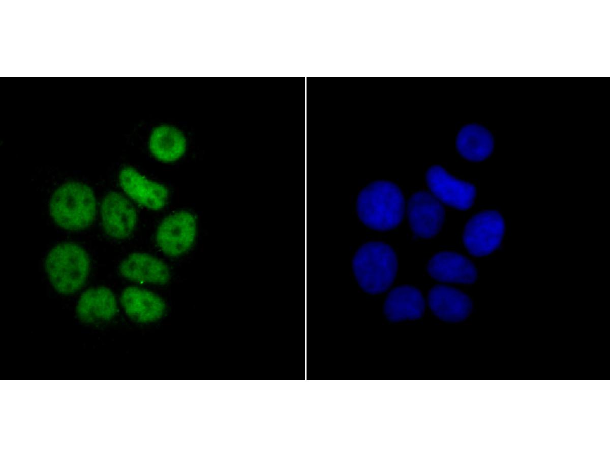 ICC staining RbAP48 in MCF-7 cells (green). The nuclear counter stain is DAPI (blue). Cells were fixed in paraformaldehyde, permeabilised with 0.25% Triton X100/PBS.