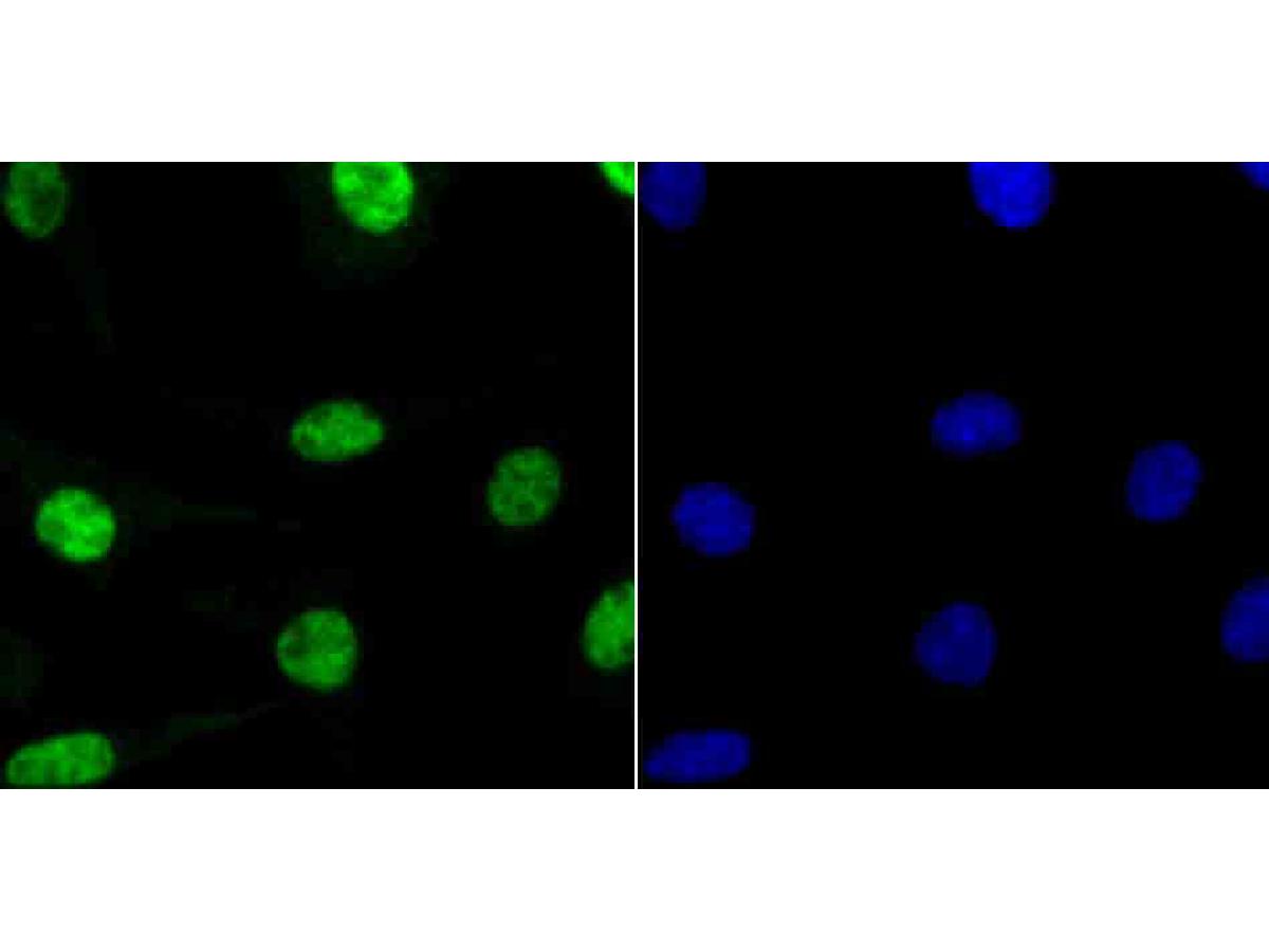 ICC staining RbAP48 in SH-SY5Y cells (green). The nuclear counter stain is DAPI (blue). Cells were fixed in paraformaldehyde, permeabilised with 0.25% Triton X100/PBS.