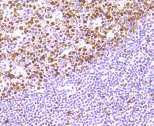 Immunohistochemical analysis of paraffin-embedded human tonsil tissue using anti-RbAP48 antibody. Counter stained with hematoxylin.