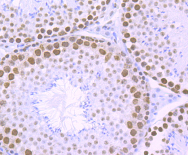Immunohistochemical analysis of paraffin-embedded mouse testis tissue with Rabbit anti-RbAP48 antibody (ET1706-54) at 1/100 dilution.<br />
<br />
The section was pre-treated using heat mediated antigen retrieval with sodium citrate buffer (pH 6.0) for 2 minutes. The tissues were blocked in 1% BSA for 20 minutes at room temperature, washed with ddH2O and PBS, and then probed with the primary antibody (ET1706-54) at 1/100 dilution for 1 hour at room temperature. The detection was performed using an HRP conjugated compact polymer system. DAB was used as the chromogen. Tissues were counterstained with hematoxylin and mounted with DPX.