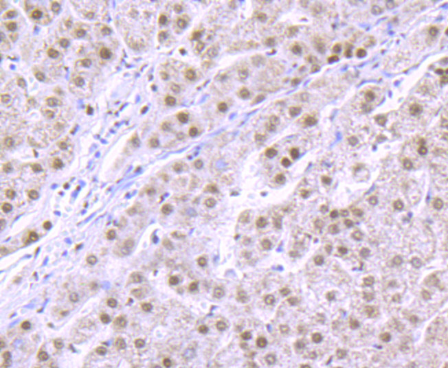 Immunohistochemical analysis of paraffin-embedded human liver tissue with Rabbit anti-RbAP48 antibody (ET1706-54) at 1/100 dilution.<br />
<br />
The section was pre-treated using heat mediated antigen retrieval with sodium citrate buffer (pH 6.0) for 2 minutes. The tissues were blocked in 1% BSA for 20 minutes at room temperature, washed with ddH2O and PBS, and then probed with the primary antibody (ET1706-54) at 1/100 dilution for 1 hour at room temperature. The detection was performed using an HRP conjugated compact polymer system. DAB was used as the chromogen. Tissues were counterstained with hematoxylin and mounted with DPX.