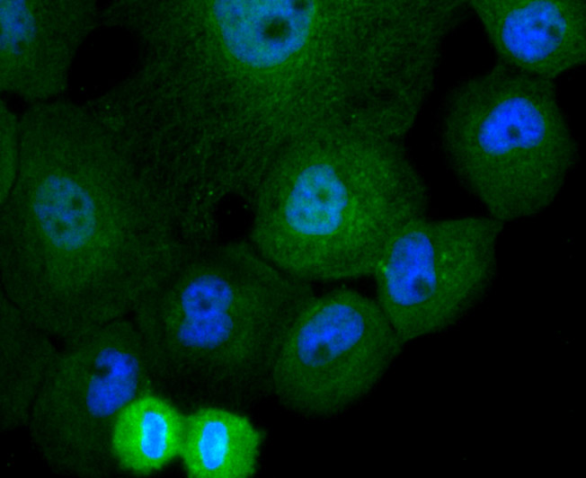 ICC staining of Cullin 4a in A431 cells (green). Formalin fixed cells were permeabilized with 0.1% Triton X-100 in TBS for 10 minutes at room temperature and blocked with 1% Blocker BSA for 15 minutes at room temperature. Cells were probed with the primary antibody (ET7106-56, 1/50) for 1 hour at room temperature, washed with PBS. Alexa Fluor®488 Goat anti-Rabbit IgG was used as the secondary antibody at 1/1,000 dilution. The nuclear counter stain is DAPI (blue).