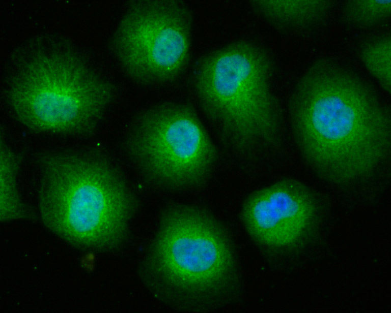 ICC staining of Cullin 4a in HUVEC cells (green). Formalin fixed cells were permeabilized with 0.1% Triton X-100 in TBS for 10 minutes at room temperature and blocked with 1% Blocker BSA for 15 minutes at room temperature. Cells were probed with the primary antibody (ET7106-56, 1/50) for 1 hour at room temperature, washed with PBS. Alexa Fluor®488 Goat anti-Rabbit IgG was used as the secondary antibody at 1/1,000 dilution. The nuclear counter stain is DAPI (blue).