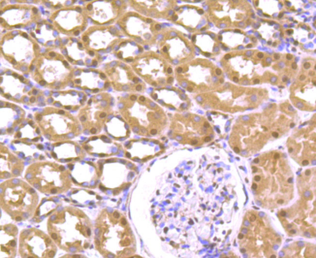 Immunohistochemical analysis of paraffin-embedded human kidney tissue using anti-Cullin 4a antibody. The section was pre-treated using heat mediated antigen retrieval with Tris-EDTA buffer (pH 8.0-8.4) for 20 minutes.The tissues were blocked in 5% BSA for 30 minutes at room temperature, washed with ddH2O and PBS, and then probed with the primary antibody (ET7106-56, 1/50) for 30 minutes at room temperature. The detection was performed using an HRP conjugated compact polymer system. DAB was used as the chromogen. Tissues were counterstained with hematoxylin and mounted with DPX.