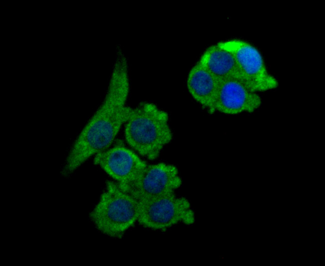 ICC staining of NCK1 in LOVO cells (green). Formalin fixed cells were permeabilized with 0.1% Triton X-100 in TBS for 10 minutes at room temperature and blocked with 10% negative goat serum for 15 minutes at room temperature. Cells were probed with the primary antibody (ET7106-57, 1/50) for 1 hour at room temperature, washed with PBS. Alexa Fluor®488 conjugate-Goat anti-Rabbit IgG was used as the secondary antibody at 1/1,000 dilution. The nuclear counter stain is DAPI (blue).