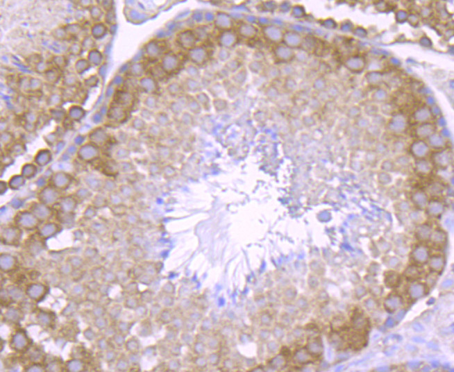 Immunohistochemical analysis of paraffin-embedded mouse testis tissue using anti-NCK1 antibody. The section was pre-treated using heat mediated antigen retrieval with Tris-EDTA buffer (pH 9.0) for 20 minutes.The tissues were blocked in 1% BSA for 30 minutes at room temperature, washed with ddH2O and PBS, and then probed with the primary antibody (ET7106-57, 1/50) for 30 minutes at room temperature. The detection was performed using an HRP conjugated compact polymer system. DAB was used as the chromogen. Tissues were counterstained with hematoxylin and mounted with DPX.